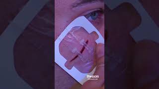 Keep These Zip Sch Bandages On Hand For Emergencies