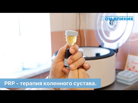 Плазмотерапия PRP в ортопедии: лечение заболеваний позвоночника и суставов без операций в ОН КЛИНИК.