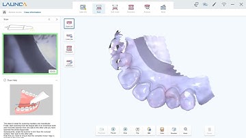 DL-300 Scan strategy - Preparation