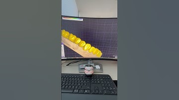 Digital Occlusion & Smile Design Preview – Exocad Workflow