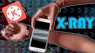 Hand X-ray on phone!!!!!! screenshot 5