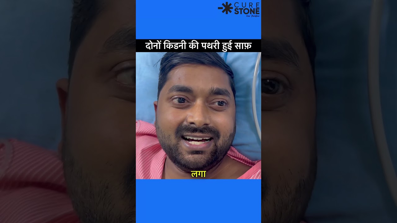 Kidney stone treatment | How kidney stones are removed | fans rirs | laser treatment | #viral Kidney stone treatment | How kidney stones are removed | fans rirs | laser treatment | #viral
