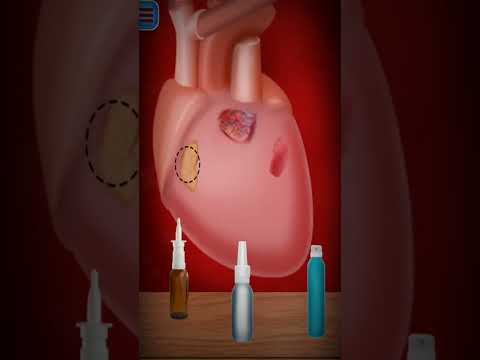 open surgery animation|openheartsurgeryanimation#opensurgery#openheartsurgery#Animation#short#viral