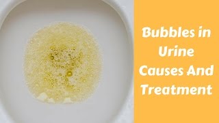 Bubbles in Urine Causes And Treatment