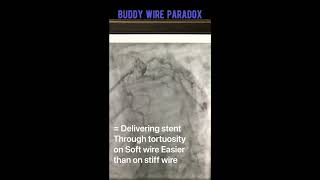 Practice Tips with Dr. Lichaa: The Buddy Wire Paradox screenshot 5