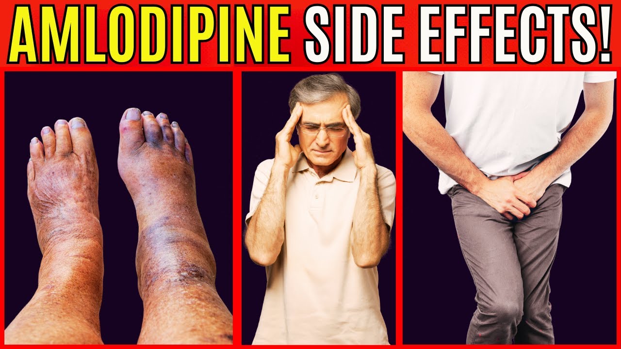Common AMLODIPINE Side Effects Why How To Reduce YouTube common-amlodipine-side-effects-why-how-to-reduce-youtube