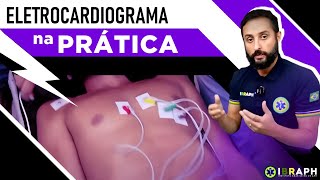 Passo a Passo: Como Realizar um ECG Corretamente (AULA PRÁTICA)