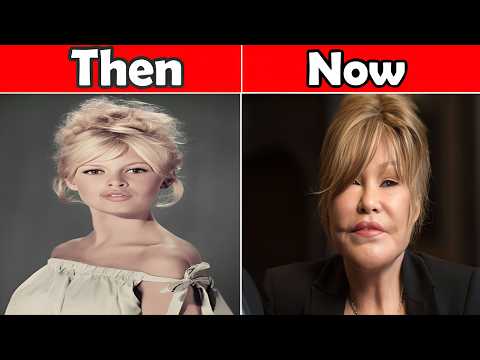 50 Celebrity Plastic