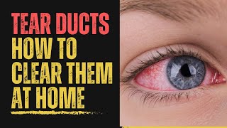 How to Treat Blocked Tear Ducts at Home: Remedies, Tips & Prevention