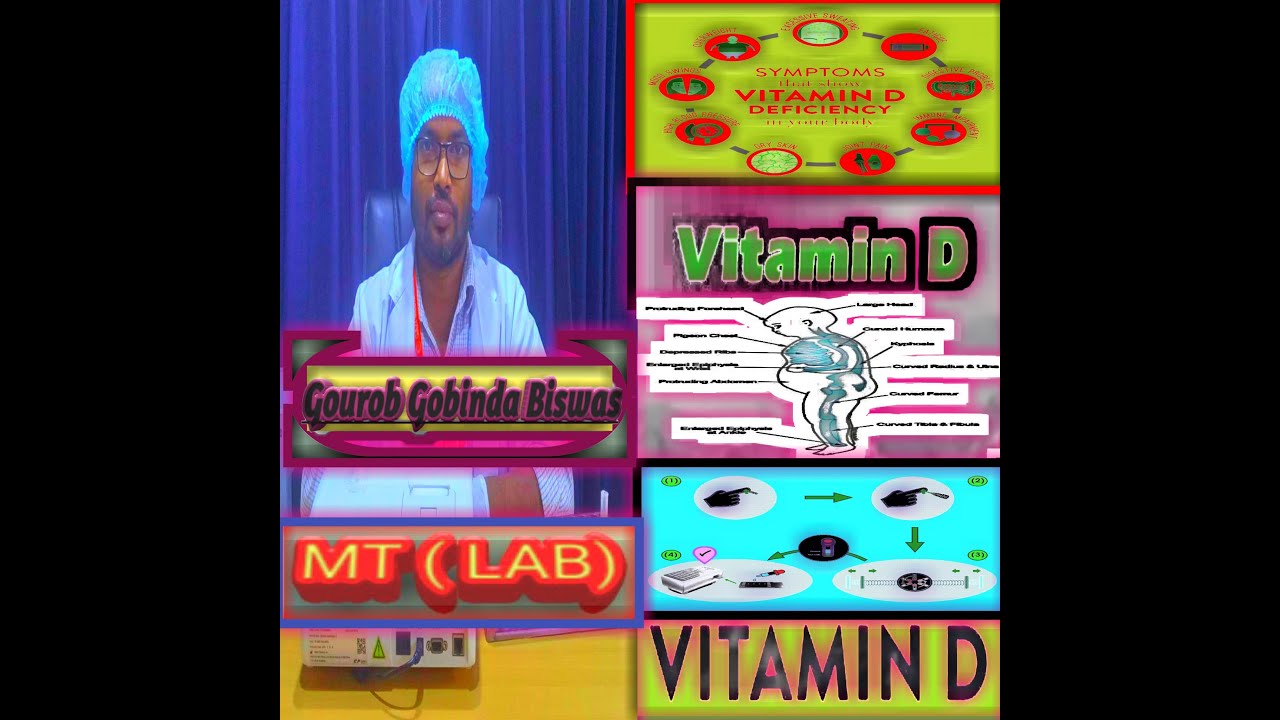 Vitamin D3 Blood Test Vitamin D3 Blood Test In Bangla YouTube Vitamin D3 Blood Test Vitamin D3 Blood Test In Bangla YouTube