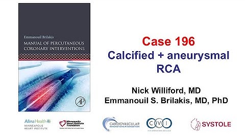 Case 196: Manual of PCI - Calcified +aneurysmal RCA