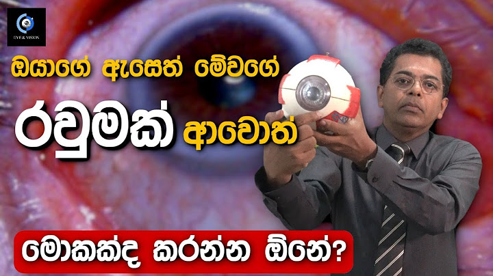 අඩු වයසින් මේ වගේ රවුමක් ඇතිවුනොත් භයානකයි | This Kind Of Circle Is Dangerous At Young Age