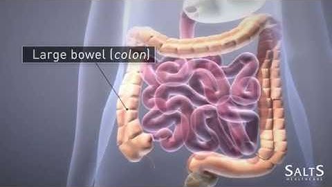 What is an Ileostomy?