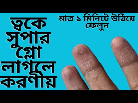 ভিডিও: আপনি কি সুপারগ্লু দিয়ে কাটা বন্ধ করতে পারেন?