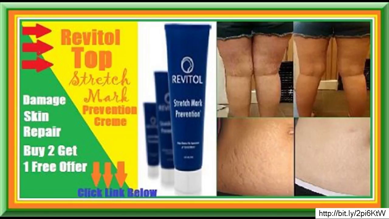 revitol stretch mark