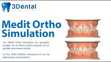 Medit Ortho Simulación