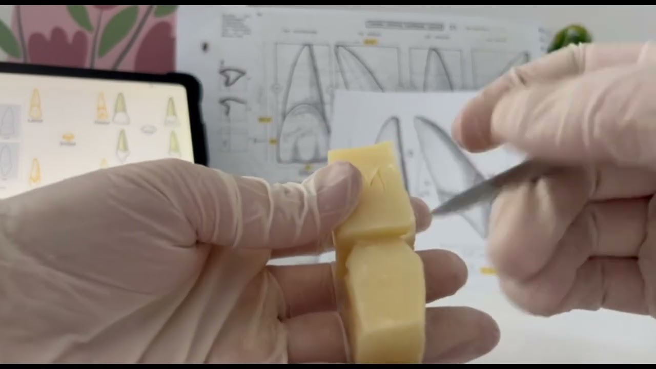 Sculpture de l'incisive centrale