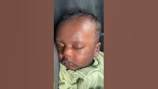 Uko umu bebe wawe yakira uduheri twomumaso burundu 