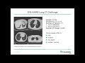 2018 - Automated lung tumor diagnosis in medical image data - methods, challenges and perspectives