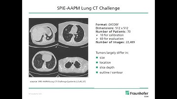 2018 - Automated lung tumor diagnosis in medical image data - methods, challenges and perspectives