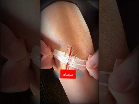 این بانداژ جونتون نجات میده