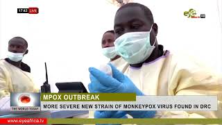 MORE SEVERE NEW STRAIN OF MONKEYPOX VIRUS FOUND IN DRC