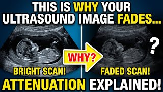 Why Do Ultrasound Images Get Darker? (Attenuation Explained) #ultrasound  #attenuation #radiology
