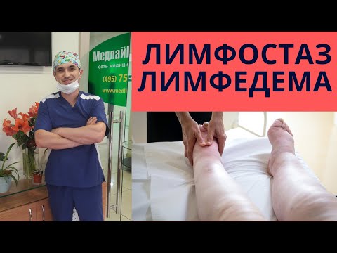 Видео: 4 прости начина за лечение на лимфедем