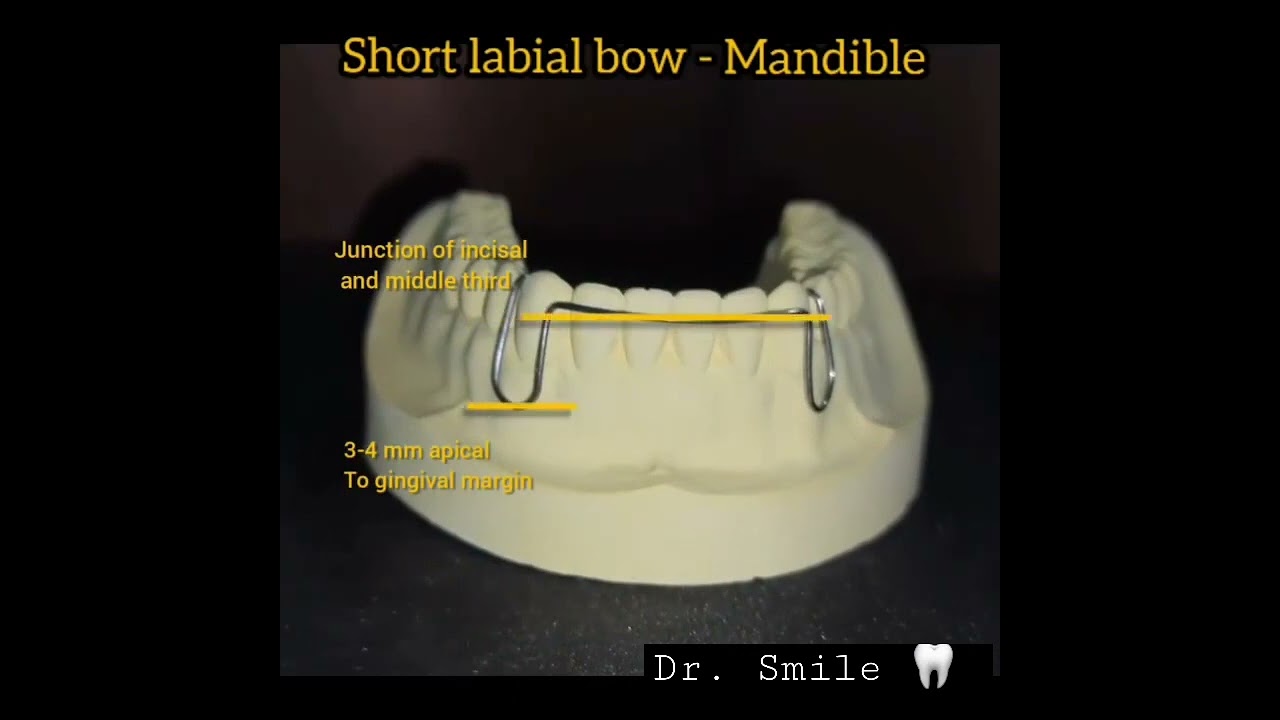 rules to be followed in making short labial bow labialbow 