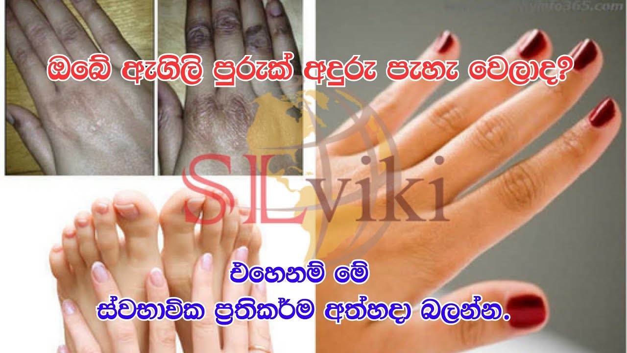 Things you can do to get rid of dark finger joints!