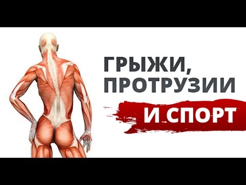 Межпозвоночные грыжи и протрузии и спорт. Часть 3. Общее и нюансы