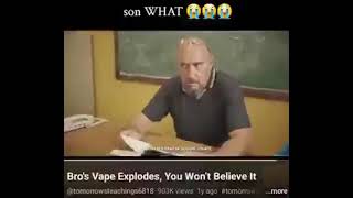 Bro's vape explodes #memes