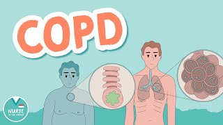 COPD  Chronic Obstructive Pulmonary Disease (Emphysema vs. Chronic Bronchitis)
