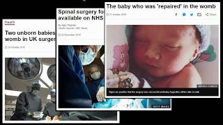 Lunch Hour Lectures: The forces that shape us: How do embryos build their spinal cord?