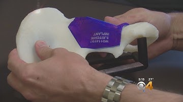 Man’s Cancerous Pelvis Replaced With 3D Printed Implant