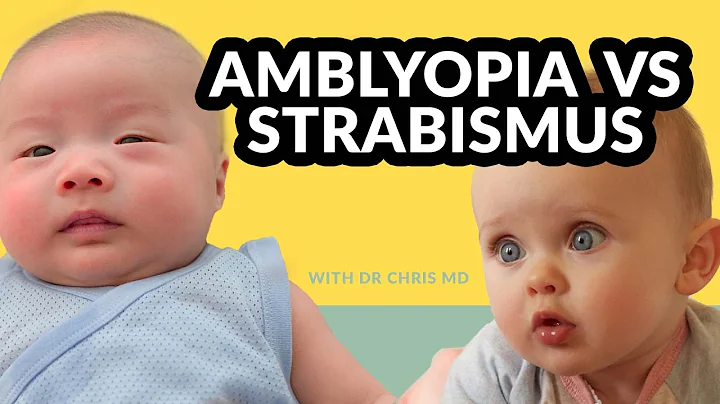 Lazy-eyed vs Cross-eyed ( amblyopia vs strabismus ) - if unnoticed can cause blindness in your baby?