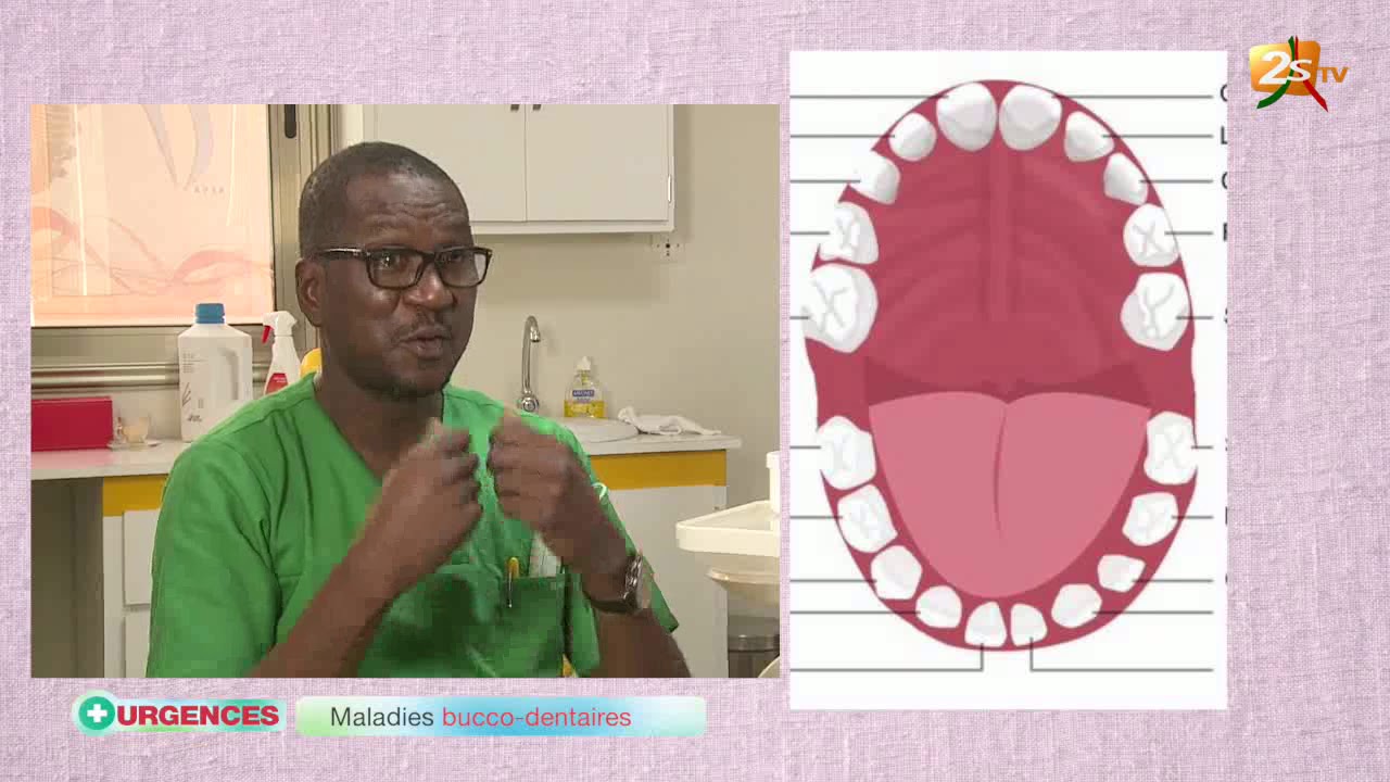 URGENCES DU 22 MARS 2018 AVEC MOUSSA SÉNE : MALADIES BUCCO-DENTAIRES