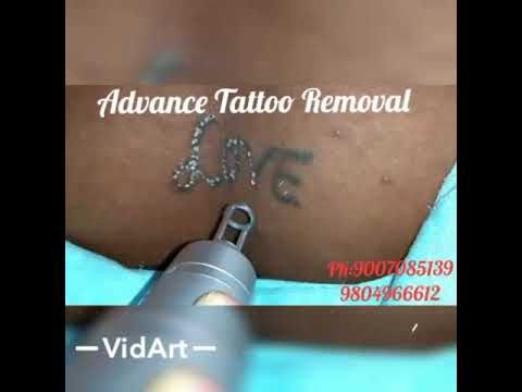 Wild Ink in Hill Cart Road,Siliguri - Best Tattoo Removal Services in  Siliguri - Justdial