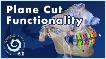 BSP5.0 New Plane Cut Functionality in BlueSkyPlan