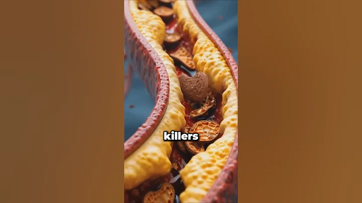 5 Foods That Clean Your Arteries Fast! #health #wellness #healthtips thumbnail