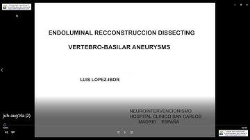 Endoluminal Recconstruccion Dissecting Vertebro-Basilar Aneurysms