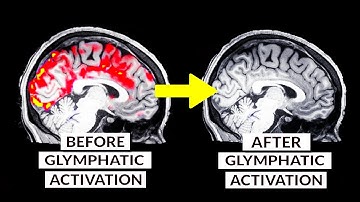 We weten eindelijk hoe we de hersenen op natuurlijke wijze kunnen ontgiften