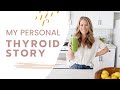Sharing My Story: Autoimmune Graves Disease Diagnosis, Hyperthyroid & My Natural Protocol