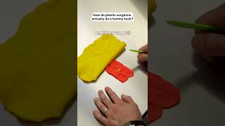 How Do Plastic Surgeons Do A Tummy Tuck?