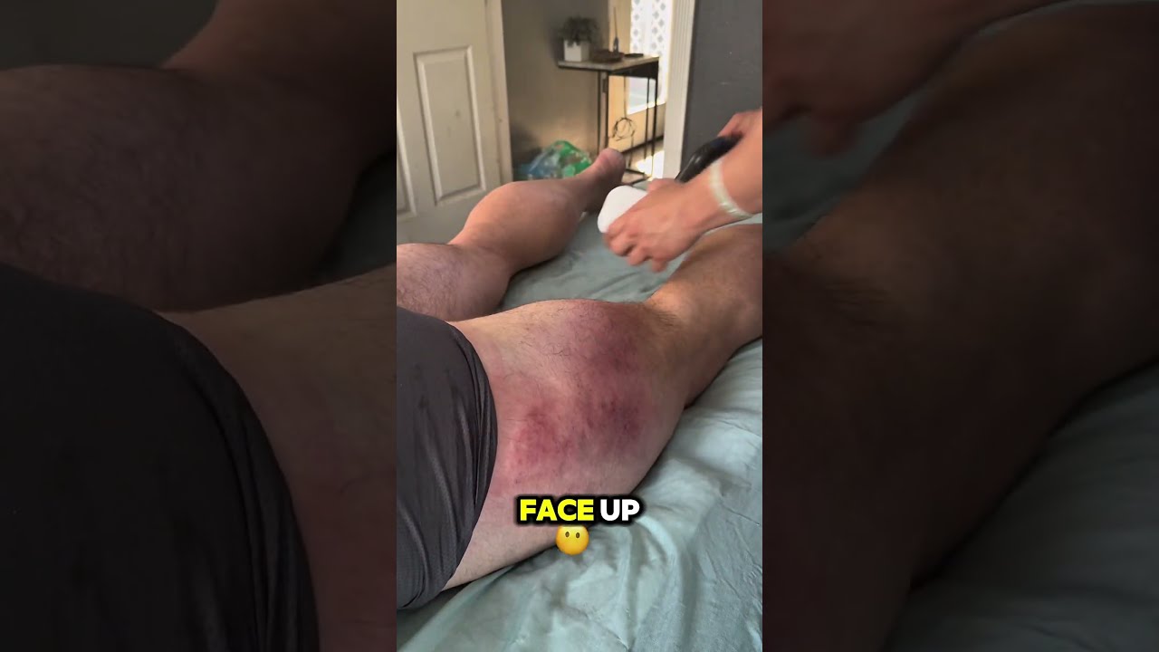 Active Release Technique Of The Hamstring 