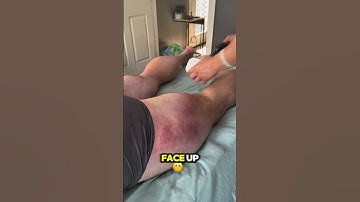 Active Release Technique of the Hamstring!