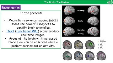 OCR Gateway B3.1.4 - The Brain Higher
