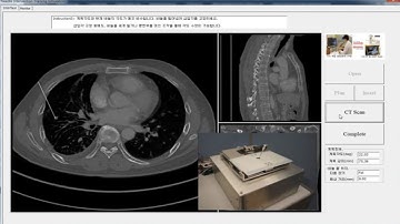 Simulation and haptic interface for needle intervention