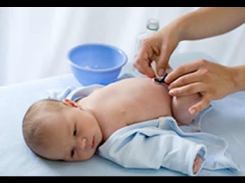 Video: Ako Vyliečiť Pupok U Novorodenca
