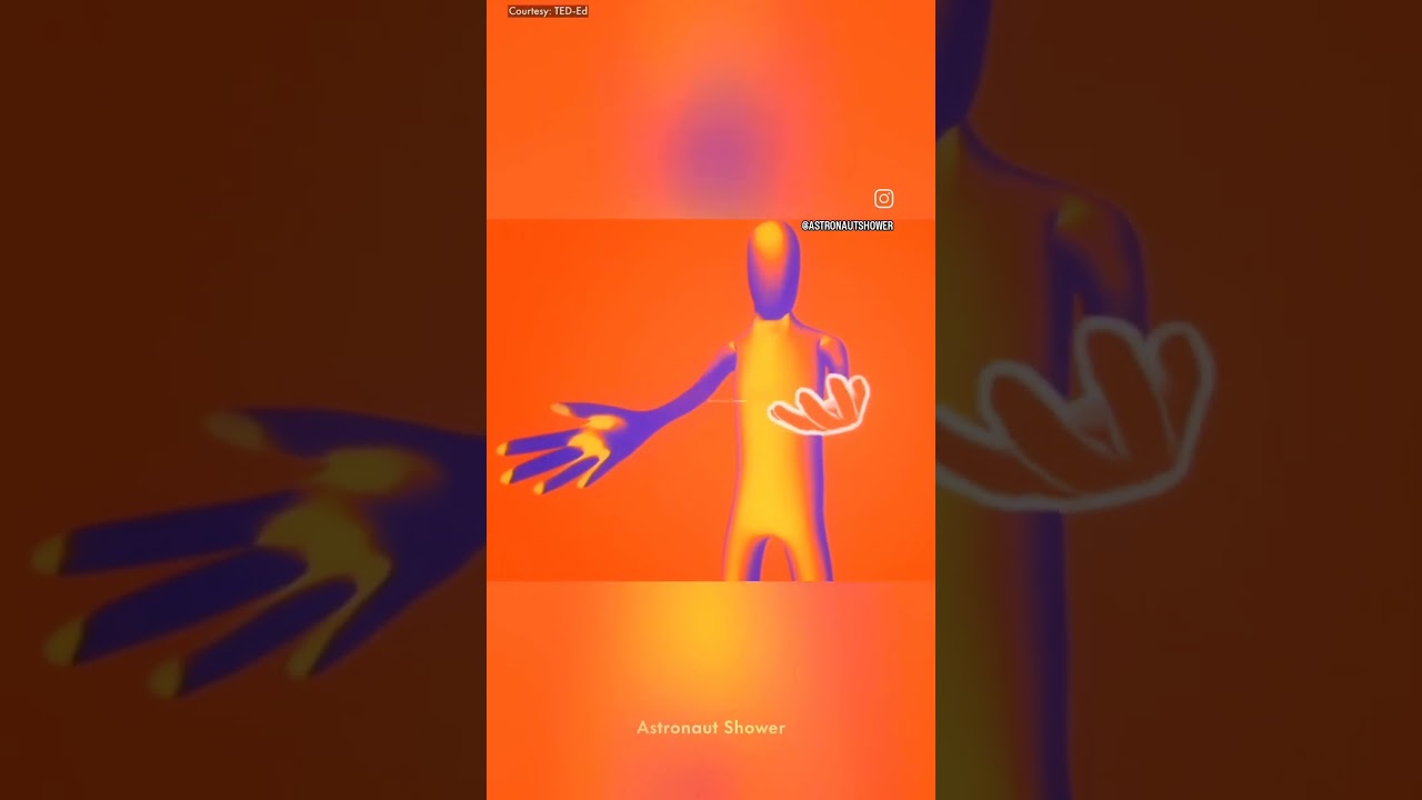 what is the fantom limb pain 